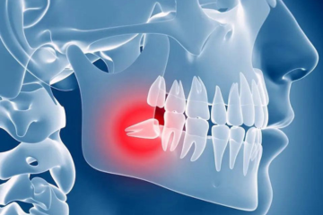 “La chirurgia degli ottavi inclusi preparazione della strumentazione”